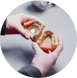 Metal Partial Denture